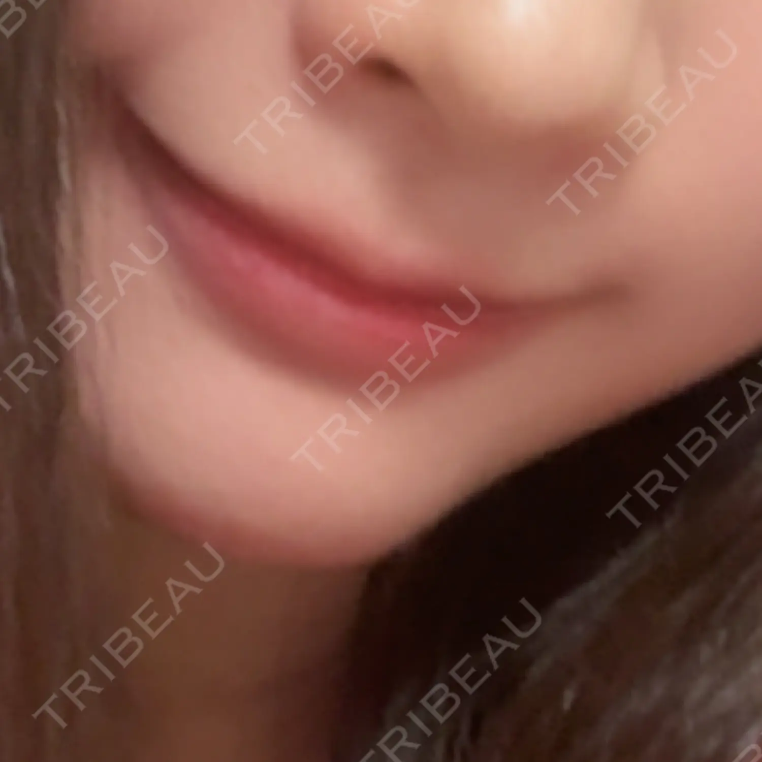 施術前の写真
