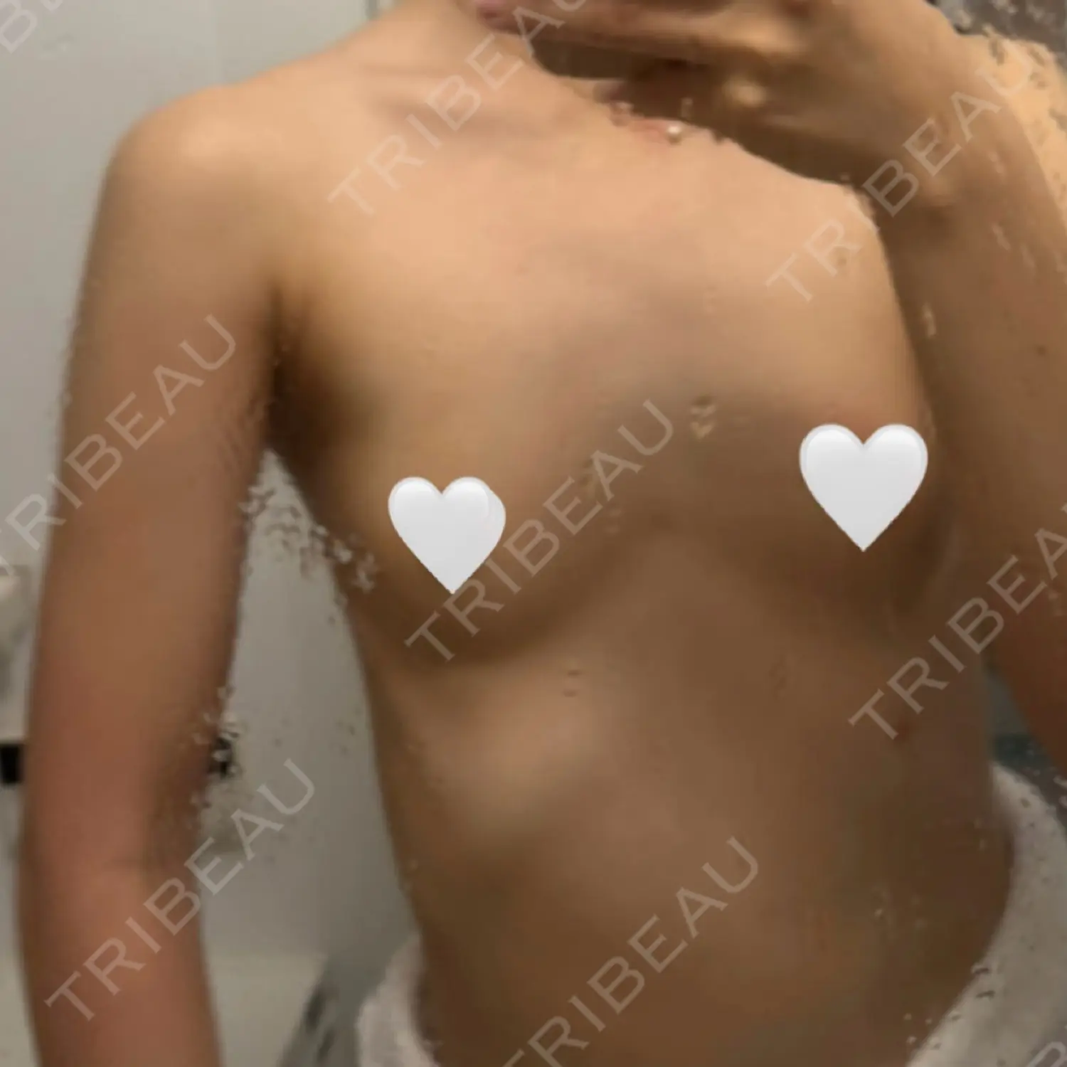 施術前の写真