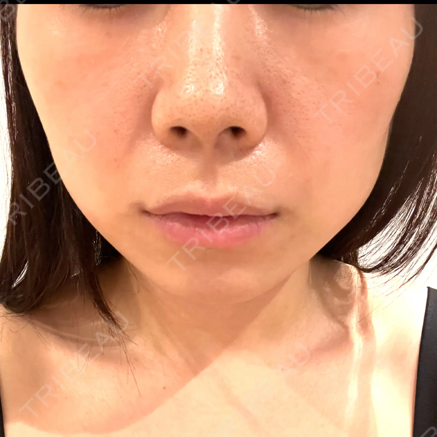 施術前の写真