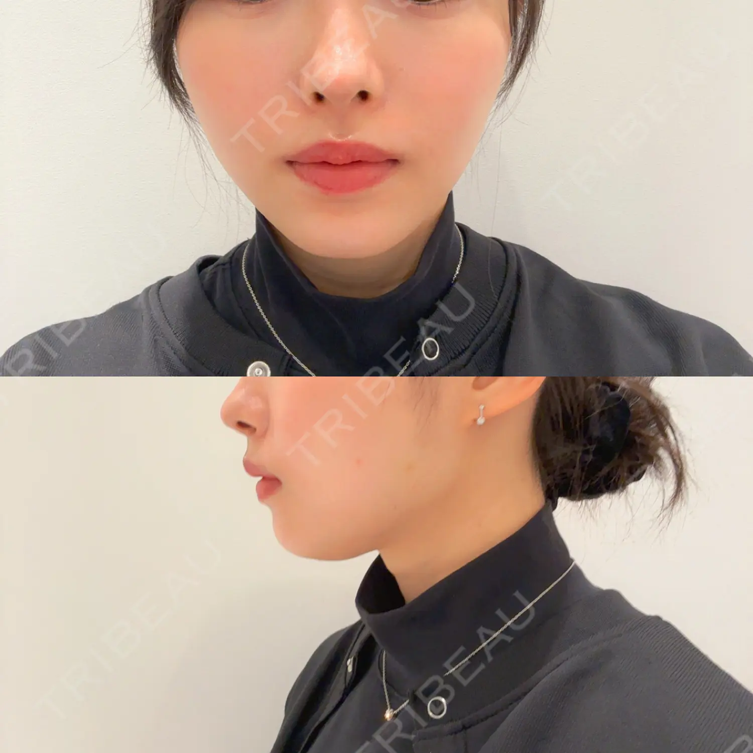 施術前の写真