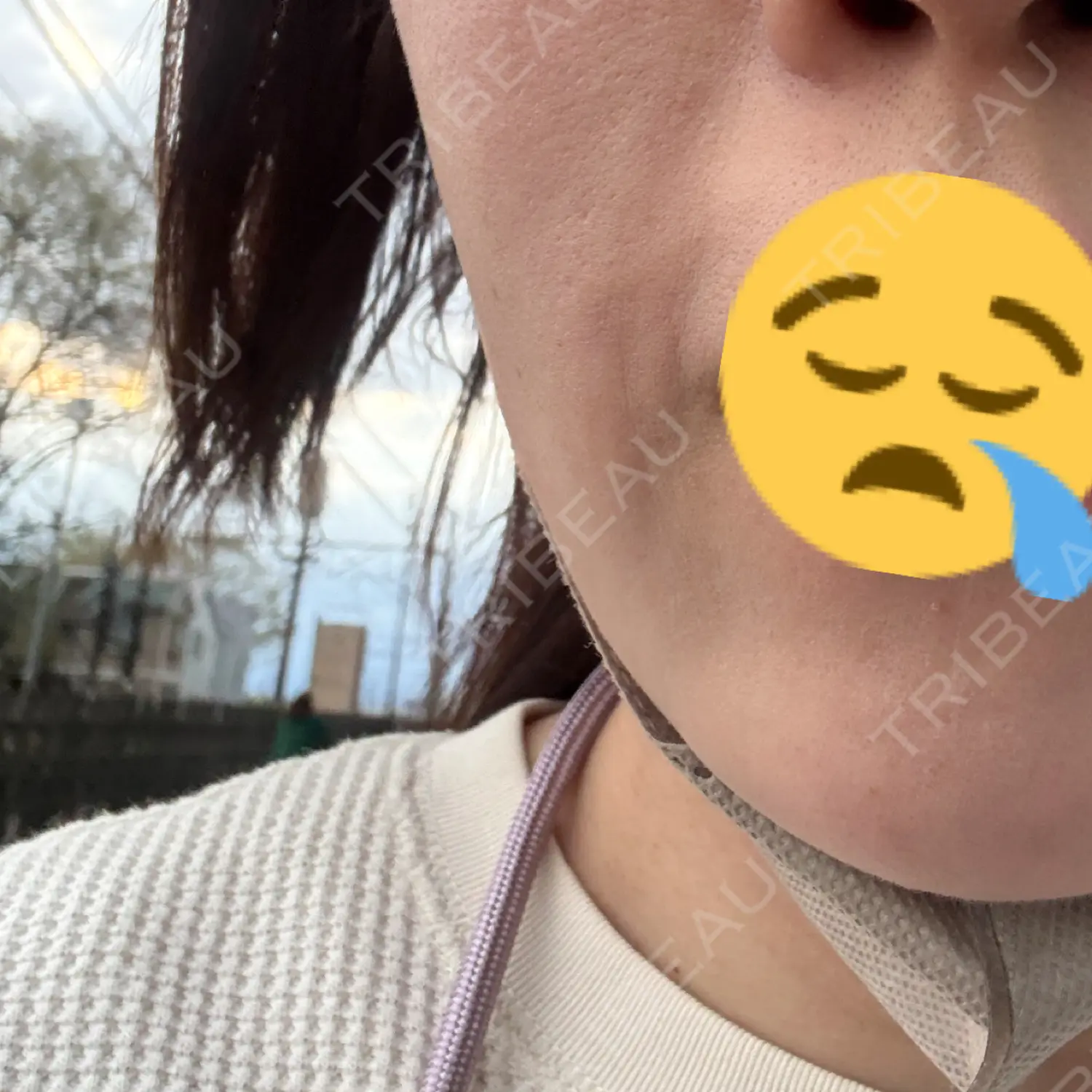 施術前の写真