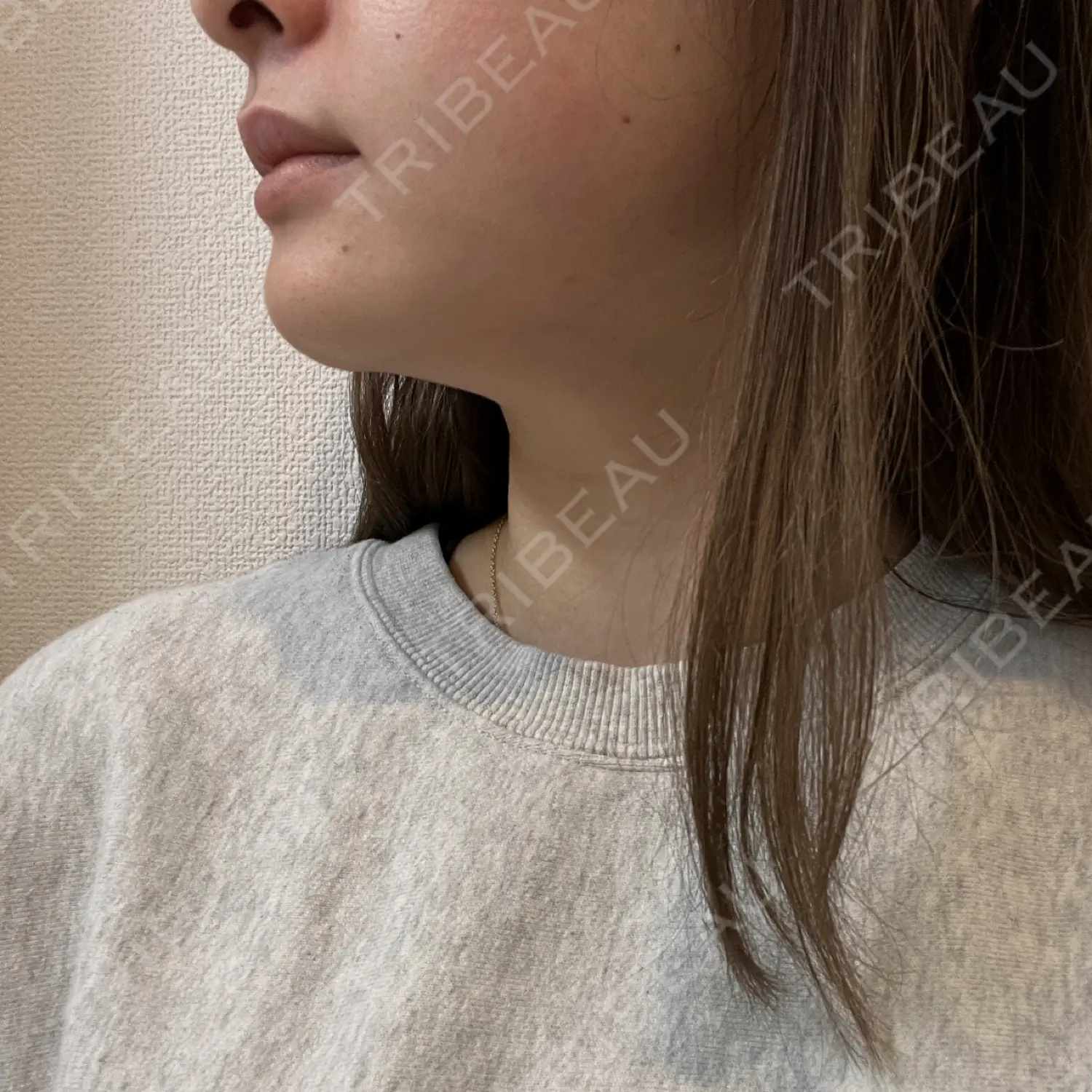 施術前の写真