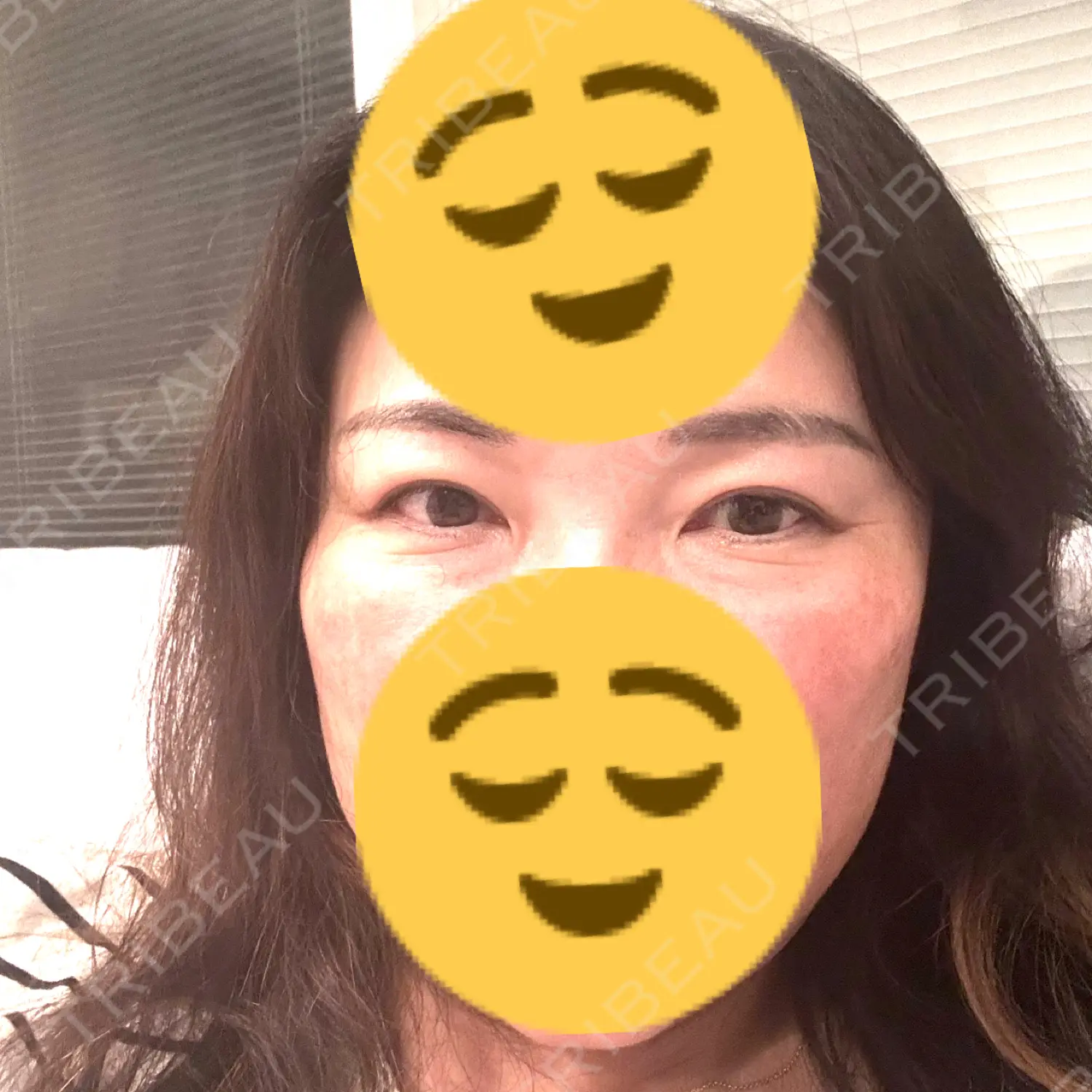 施術前の写真