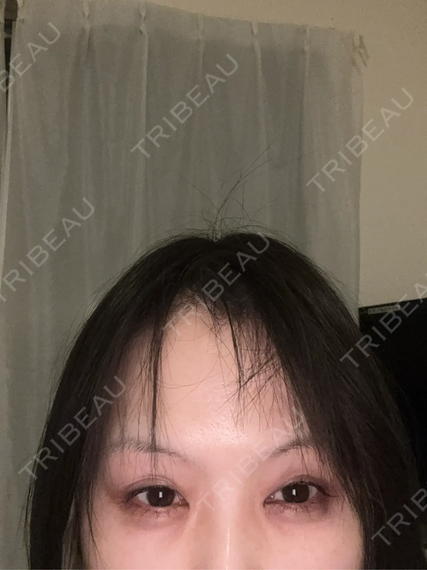 施術前の写真