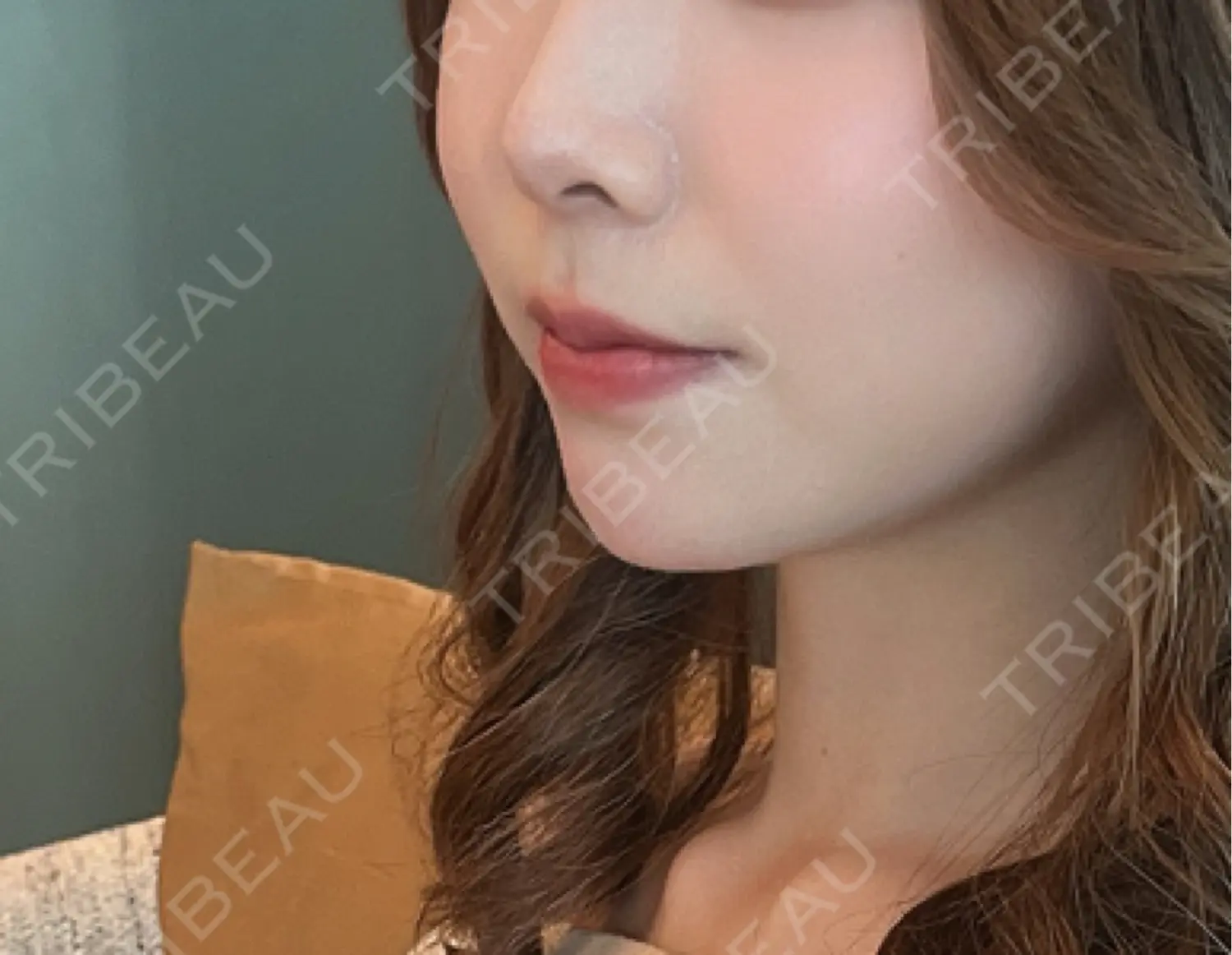 施術前の写真