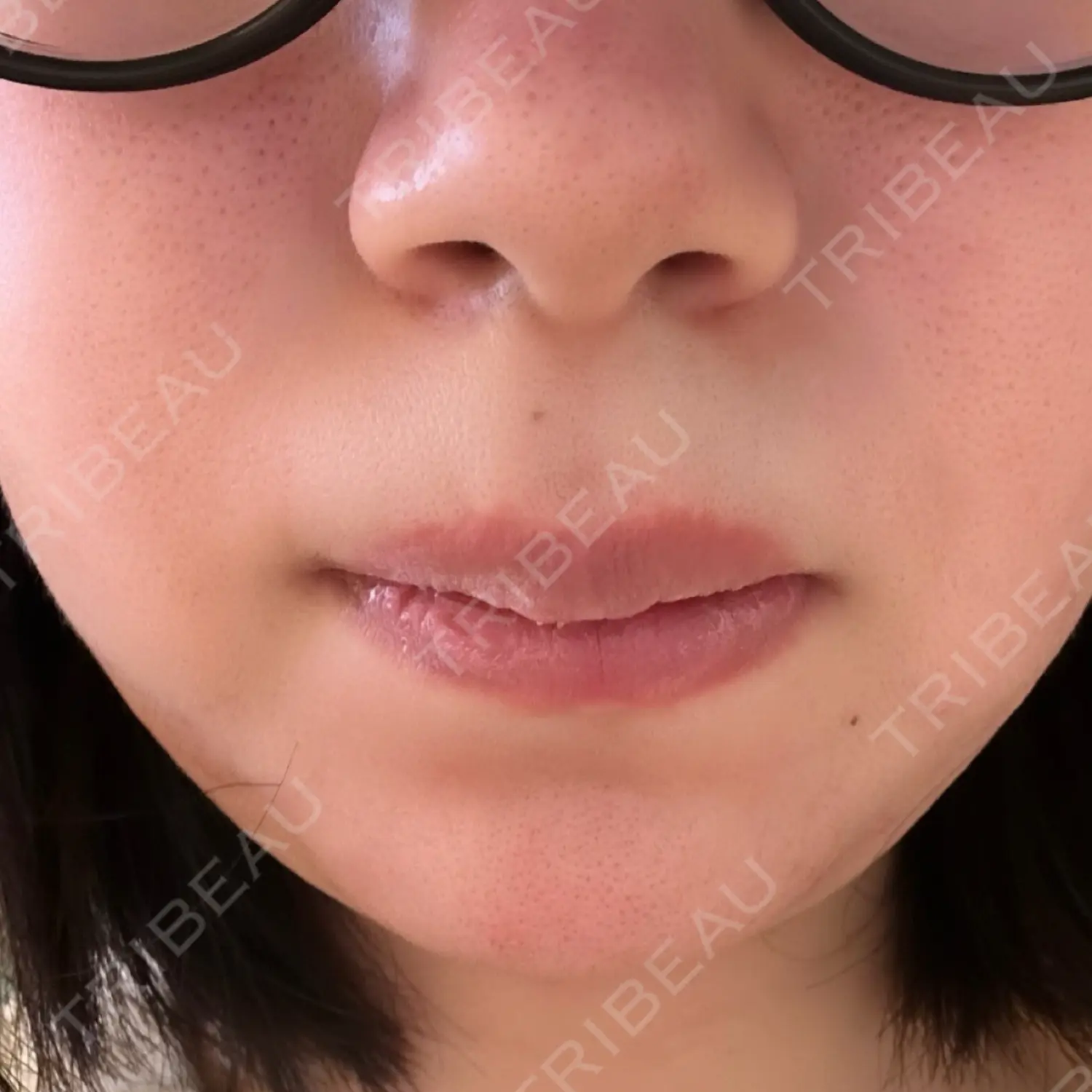 施術前の写真