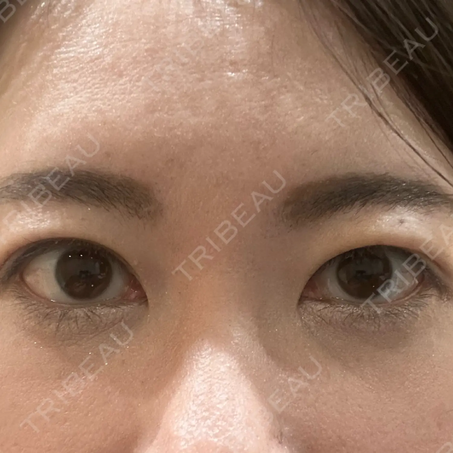 施術前の写真