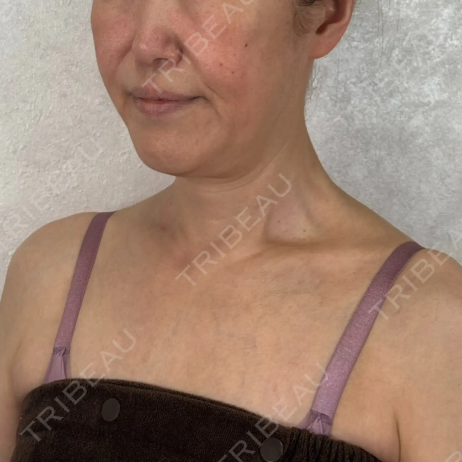 施術前の写真