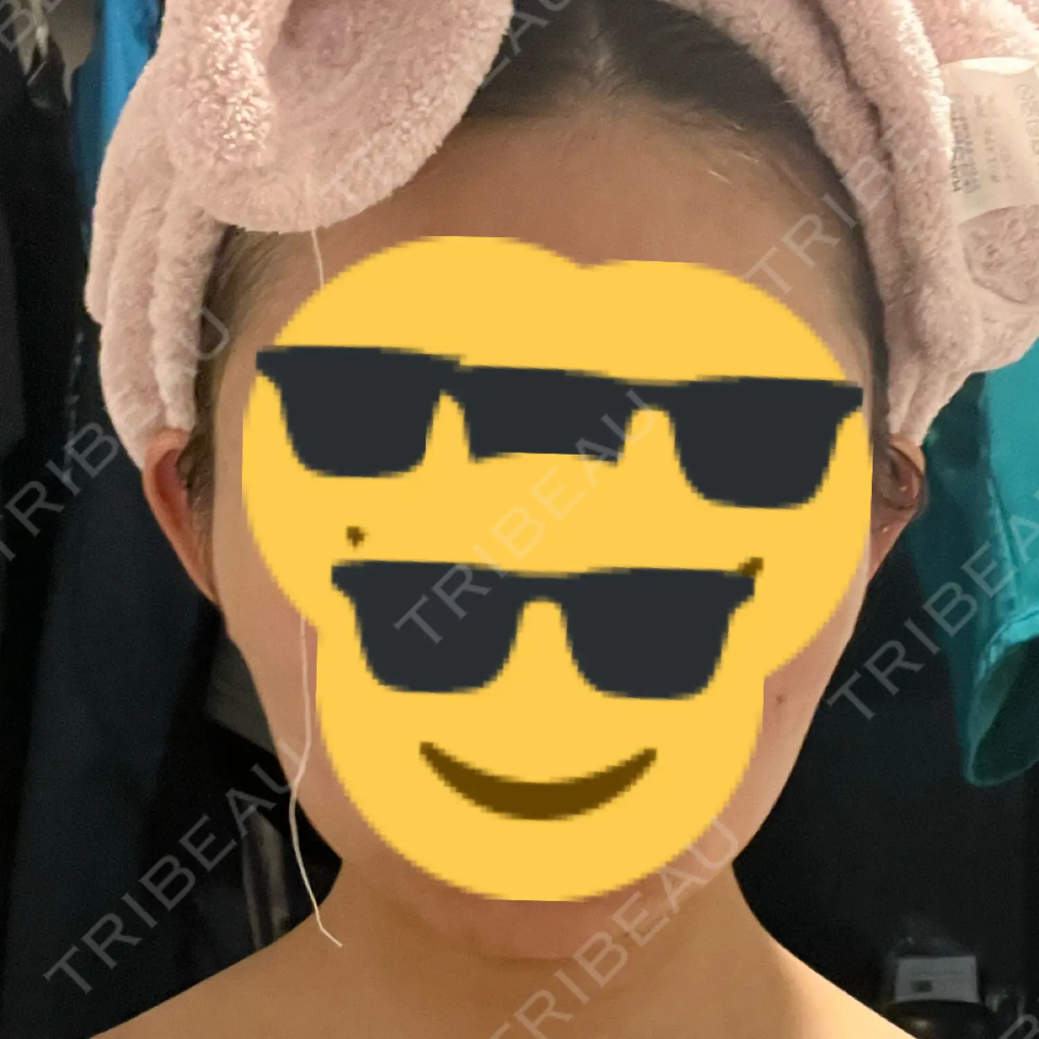 施術前の写真