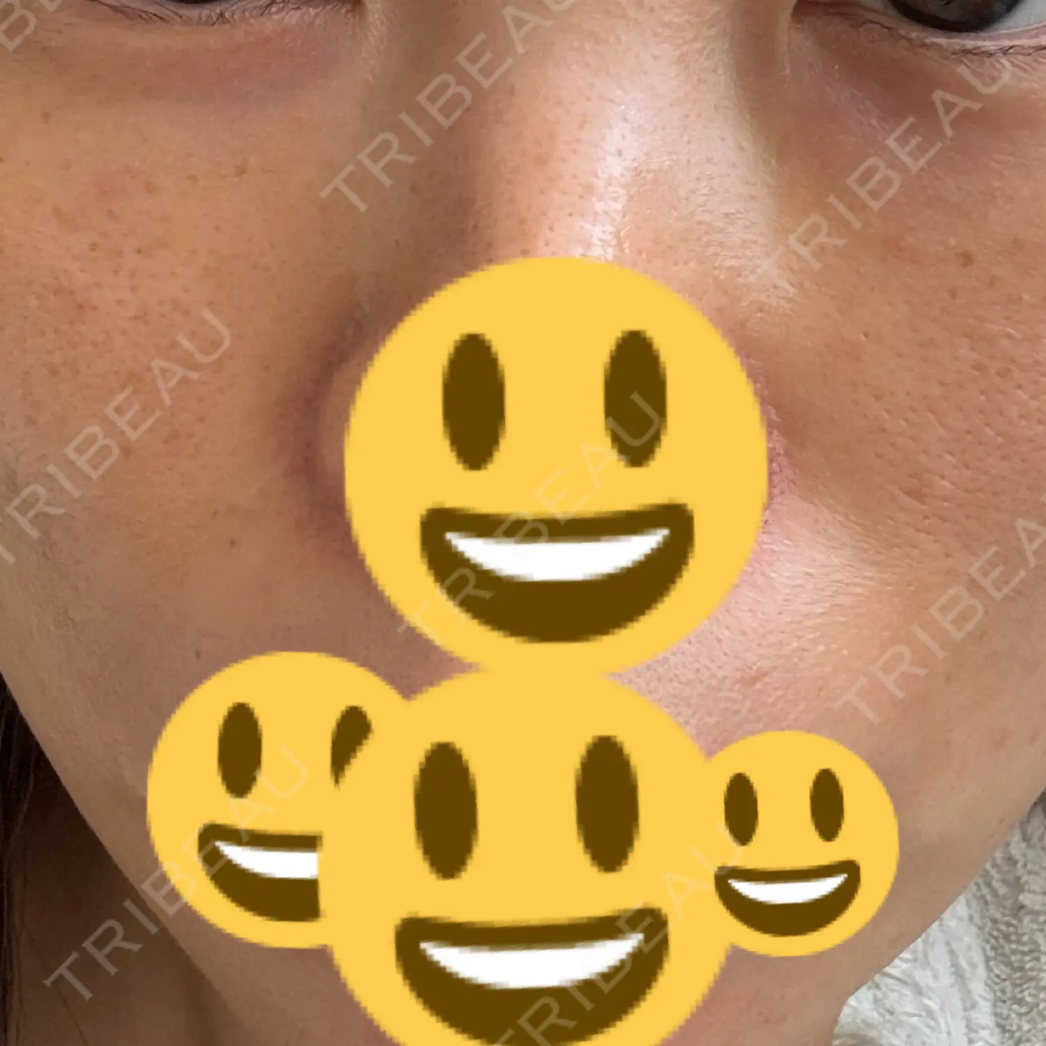 施術前の写真