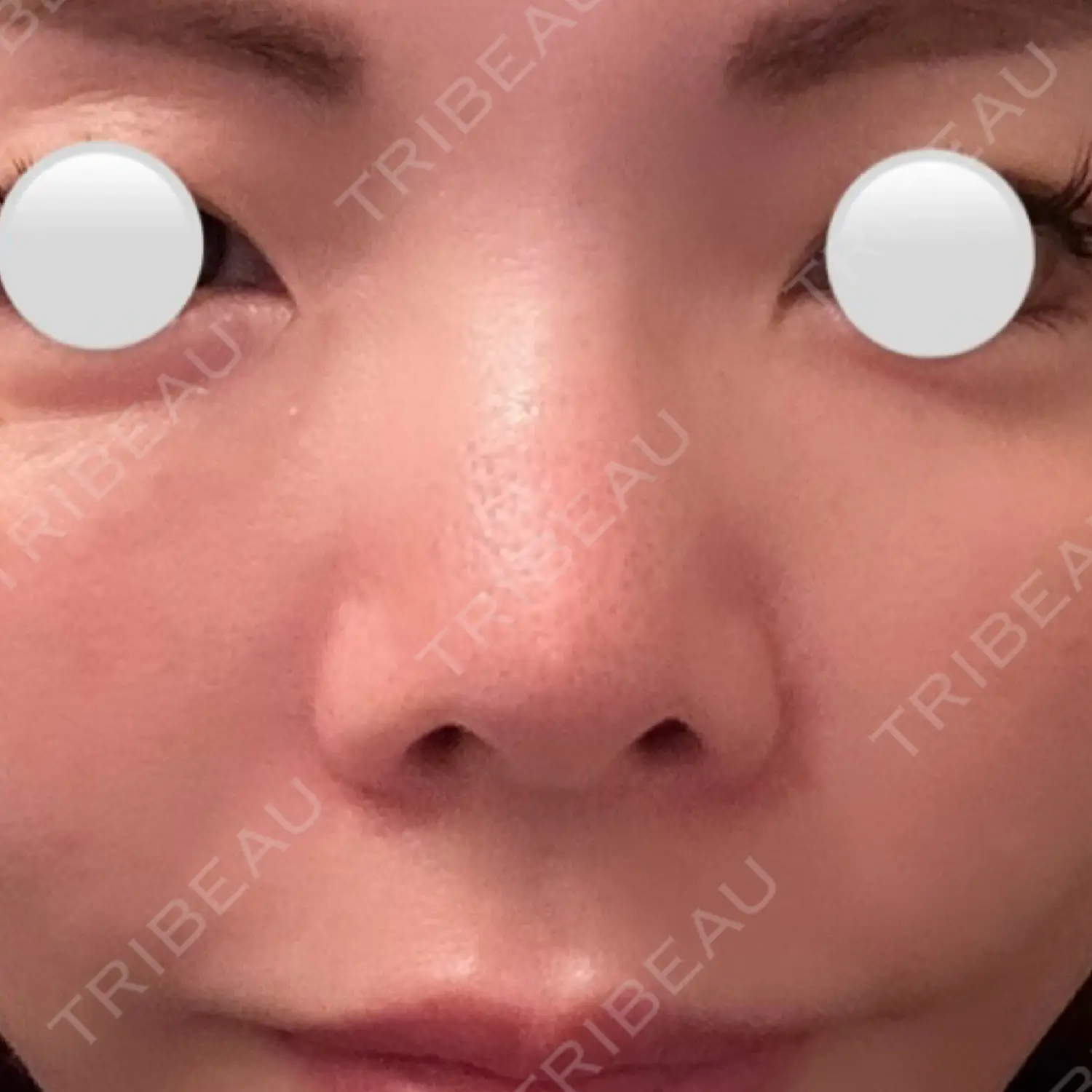施術前の写真