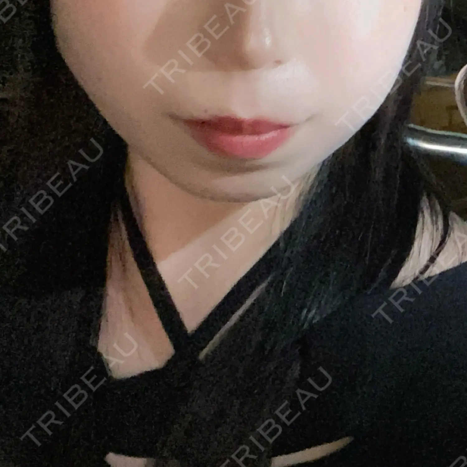 施術前の写真