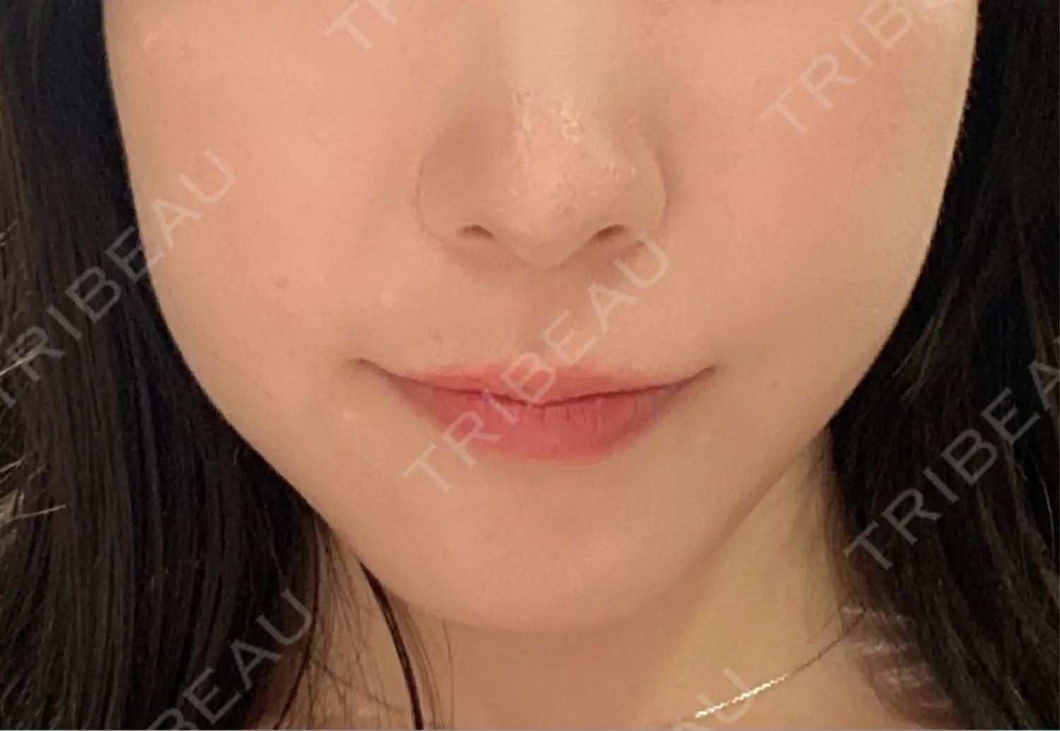 施術前の写真