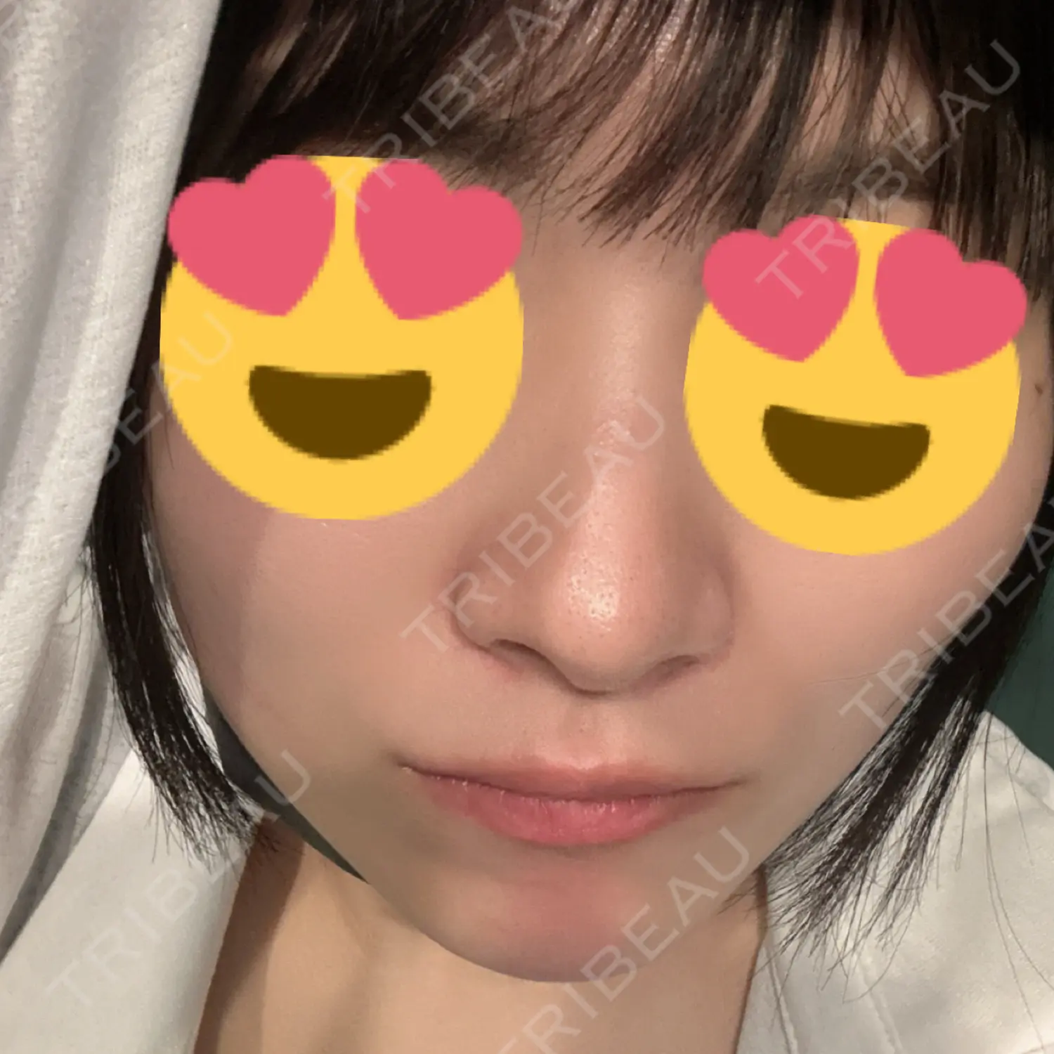 施術前の写真