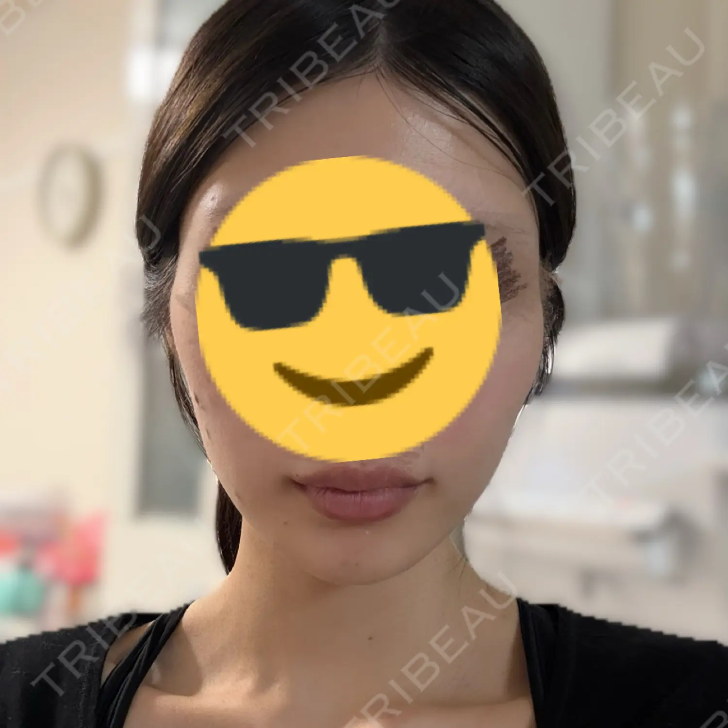 施術前の写真