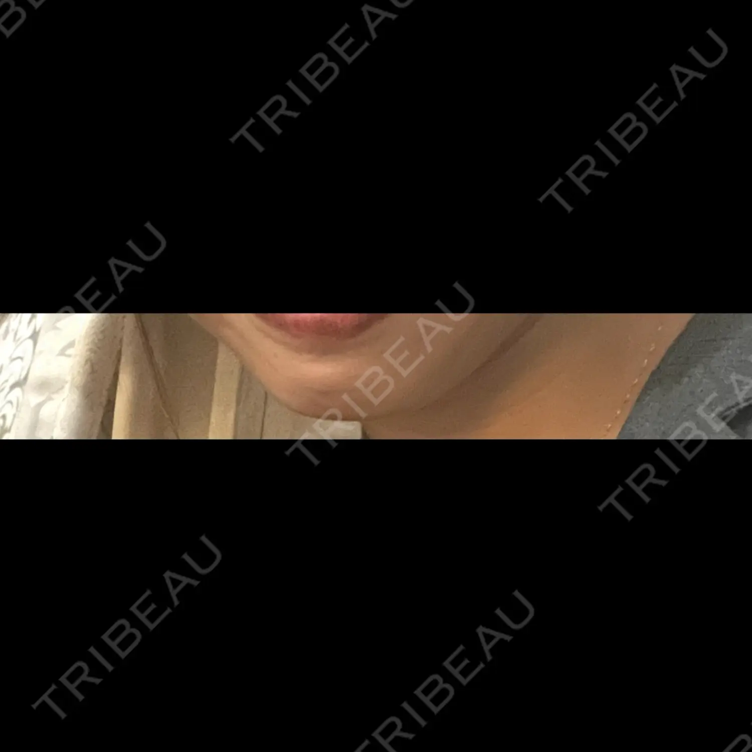 施術前の写真