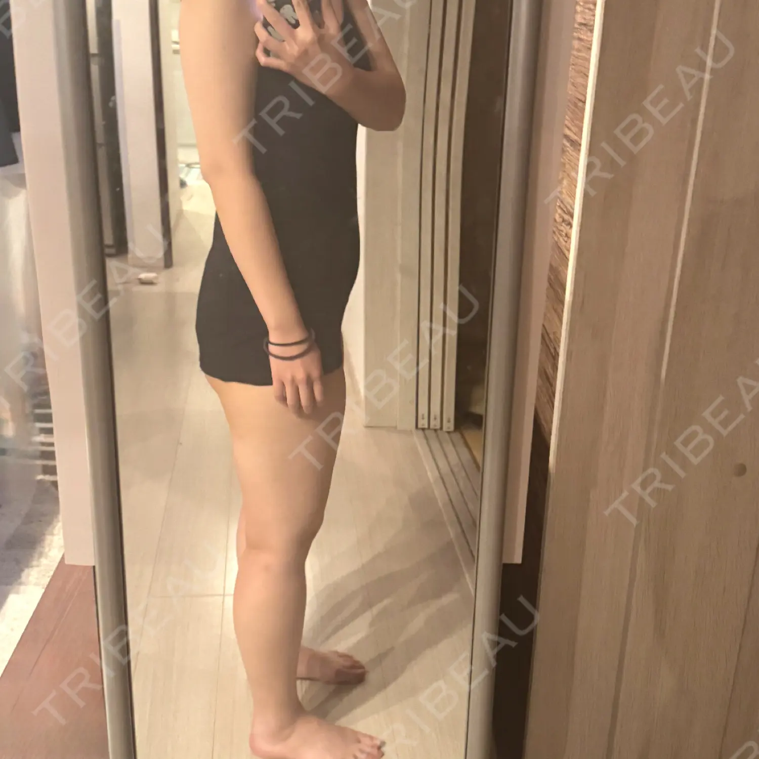 施術前の写真