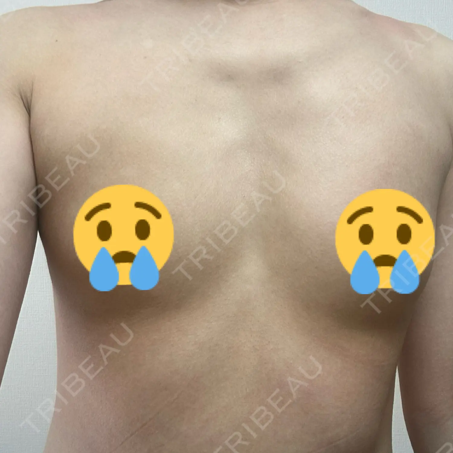 施術前の写真