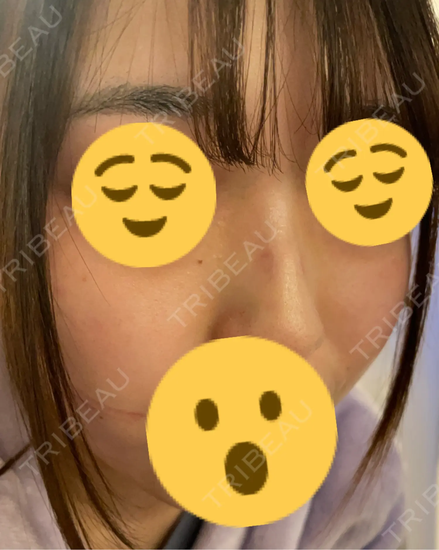 施術前の写真