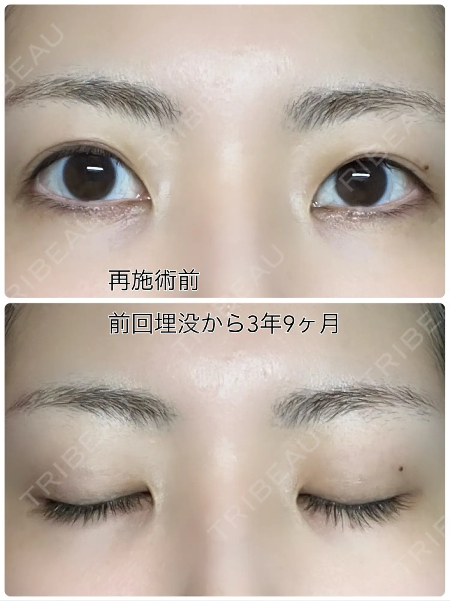 施術前の写真