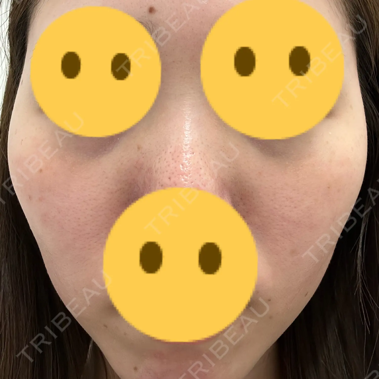 施術前の写真