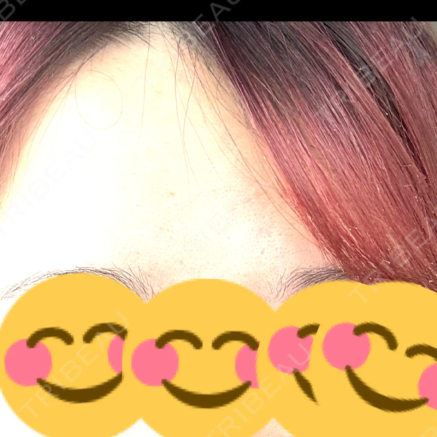 施術前の写真