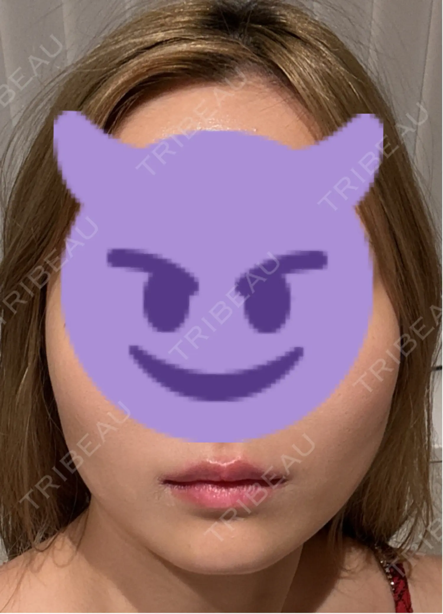 施術前の写真