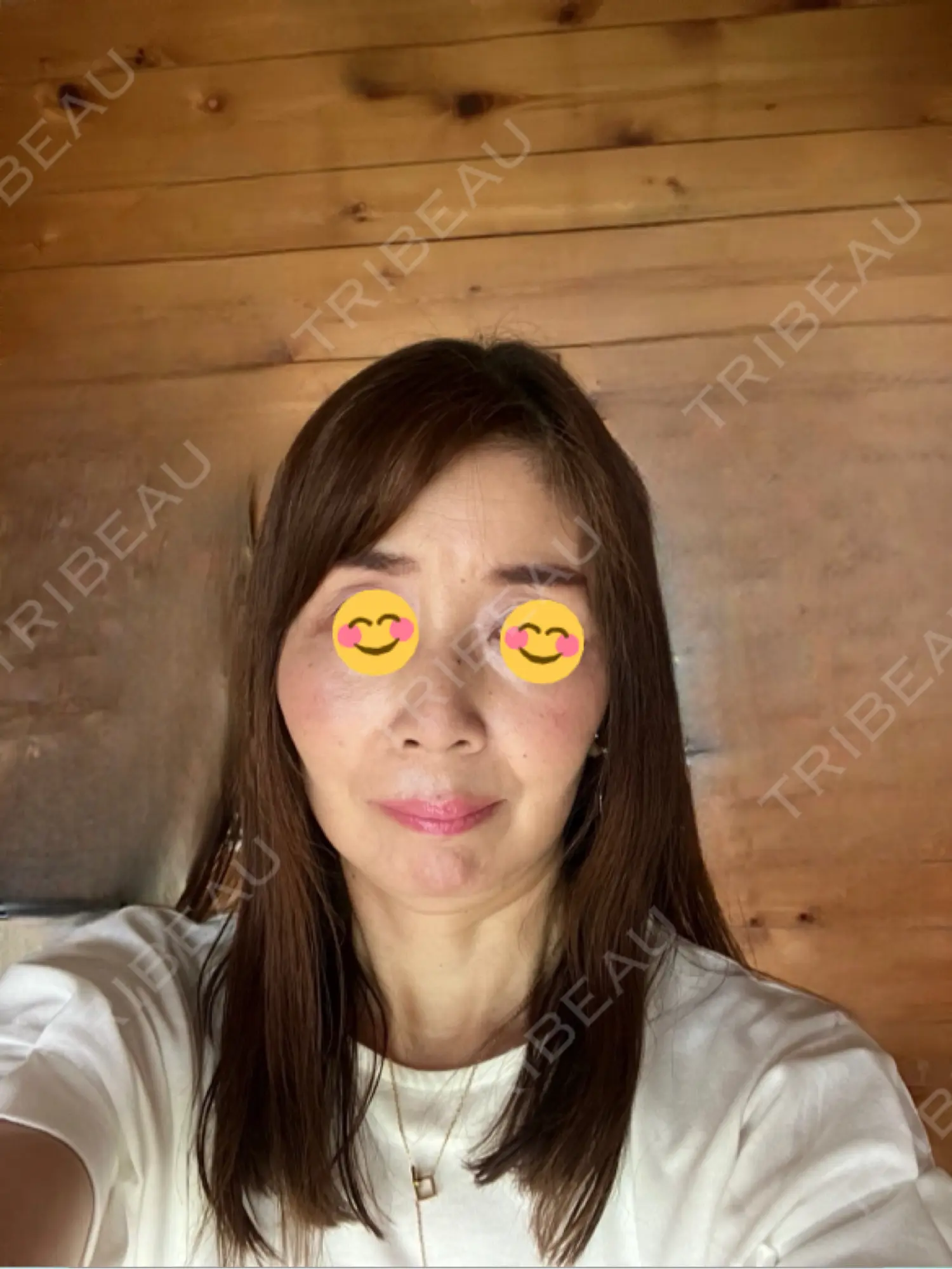 施術前の写真