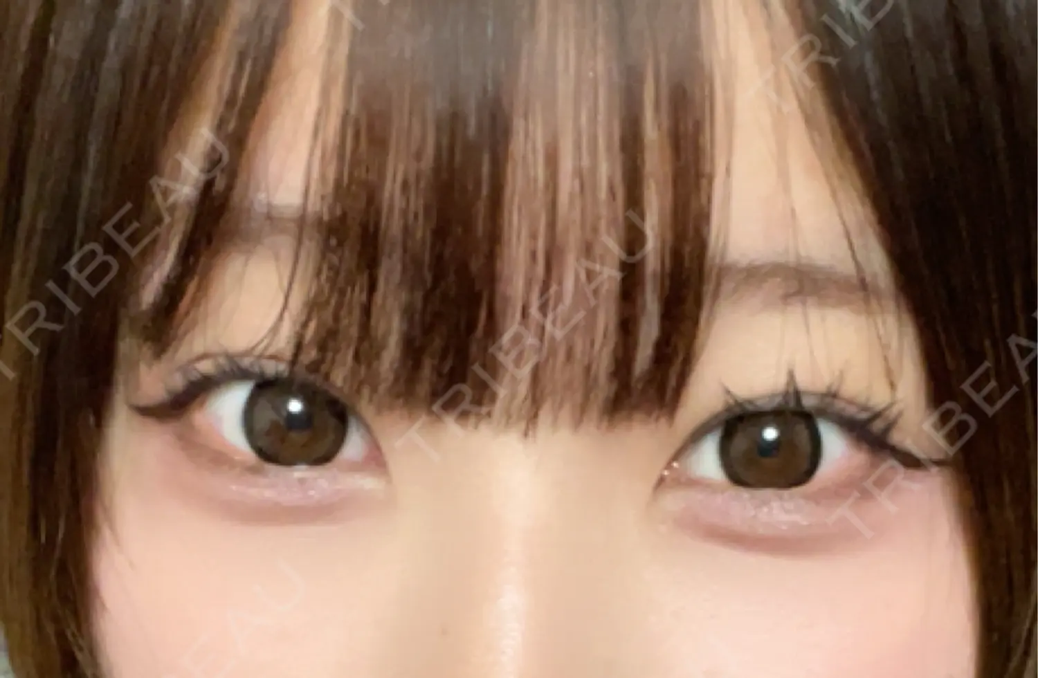施術前の写真
