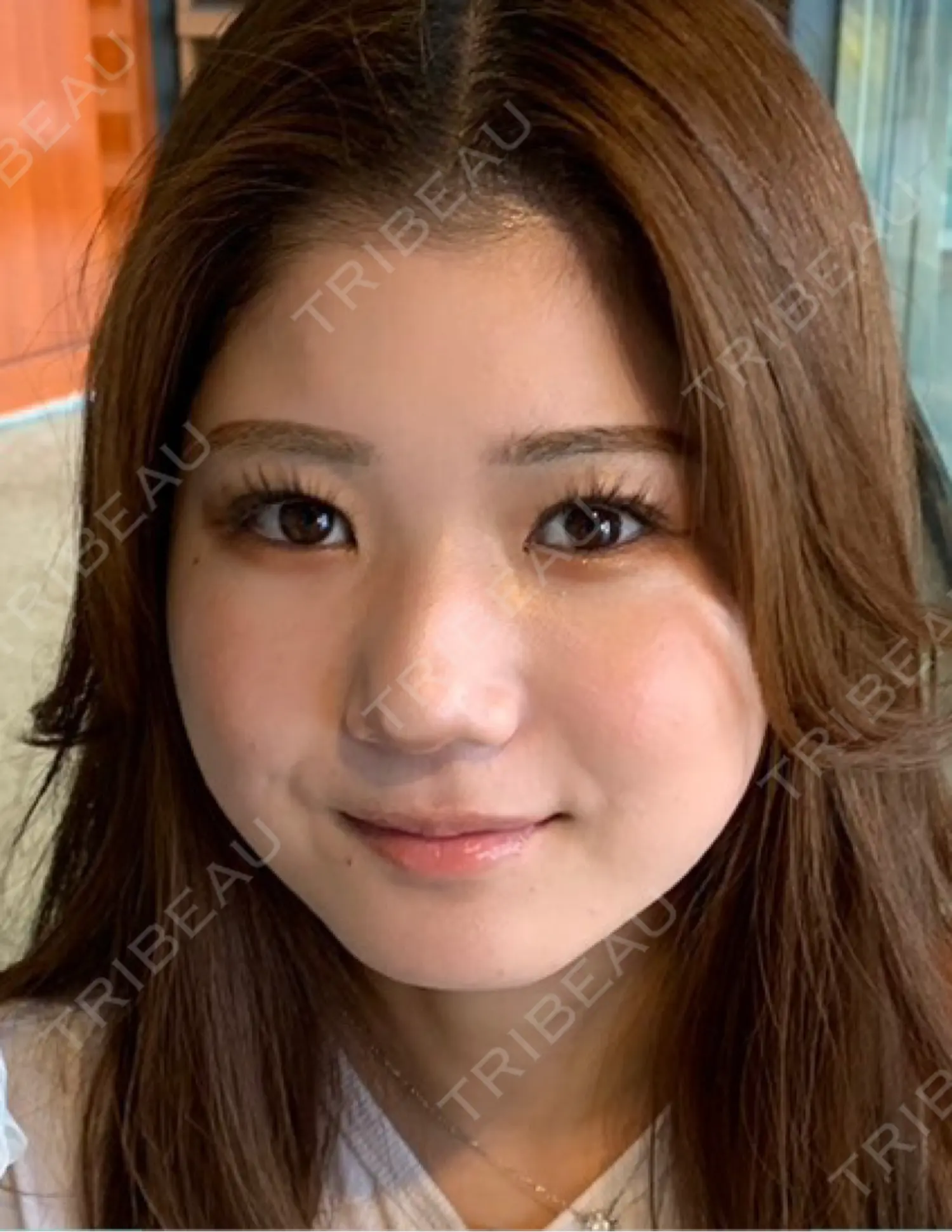 施術前の写真