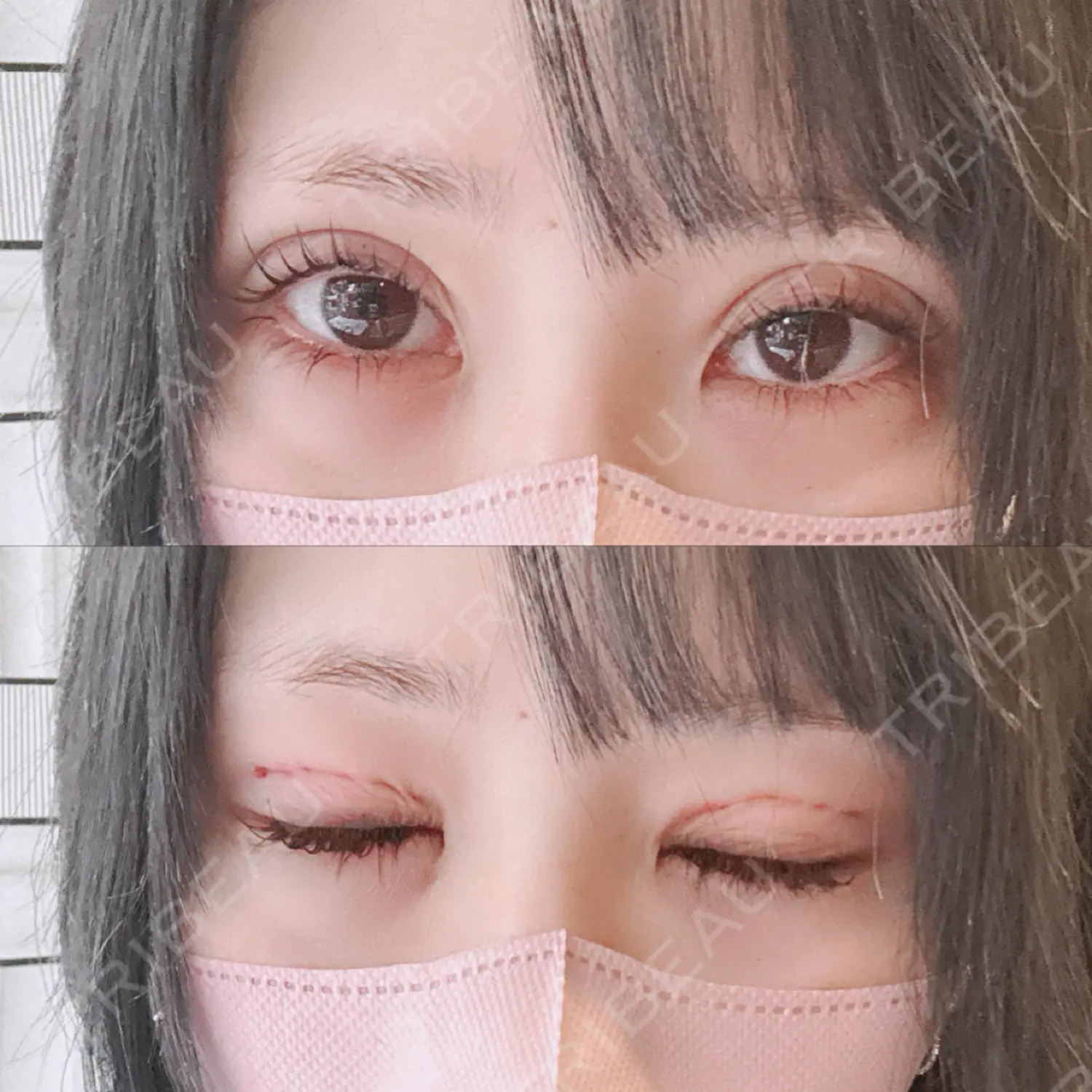 施術前の写真