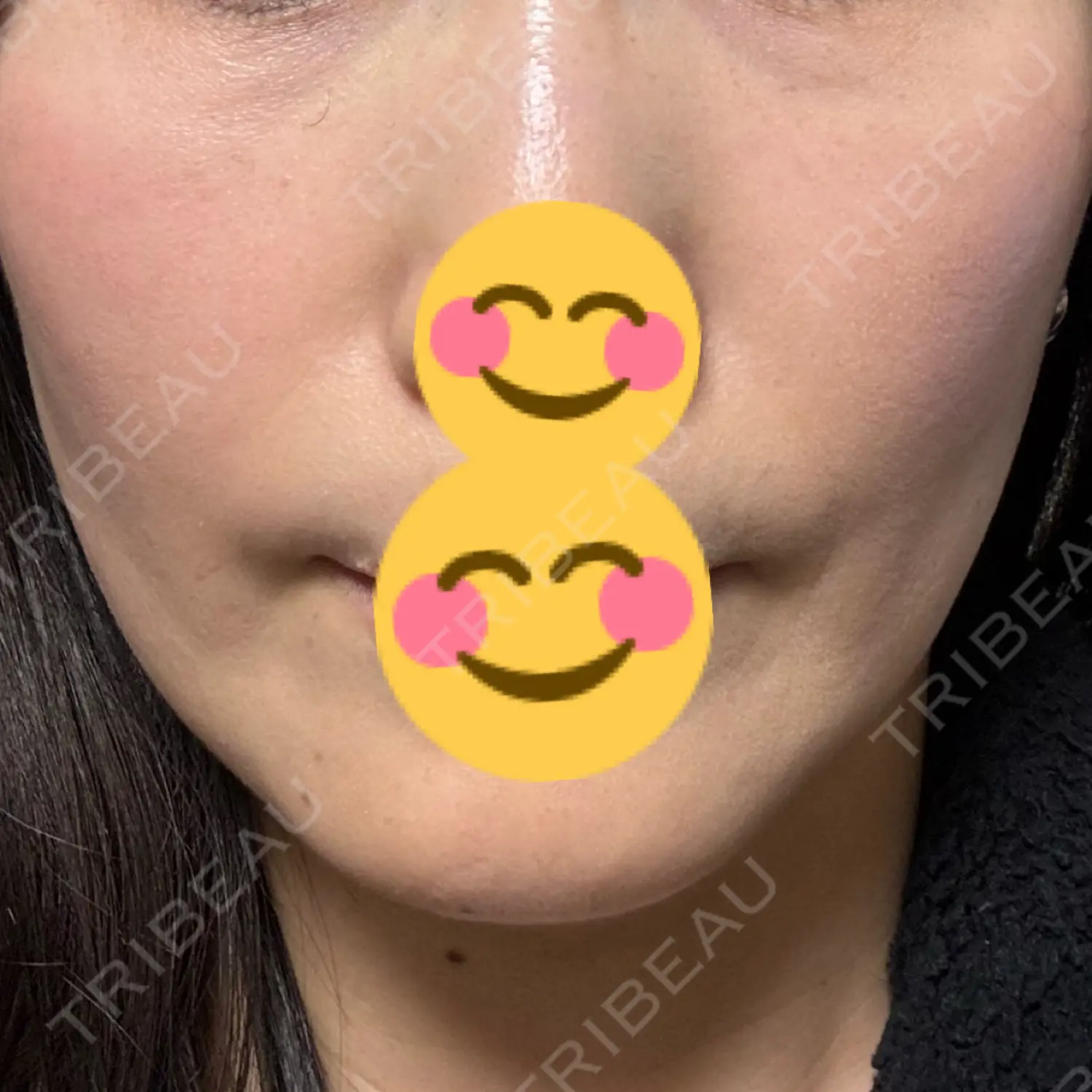 施術前の写真