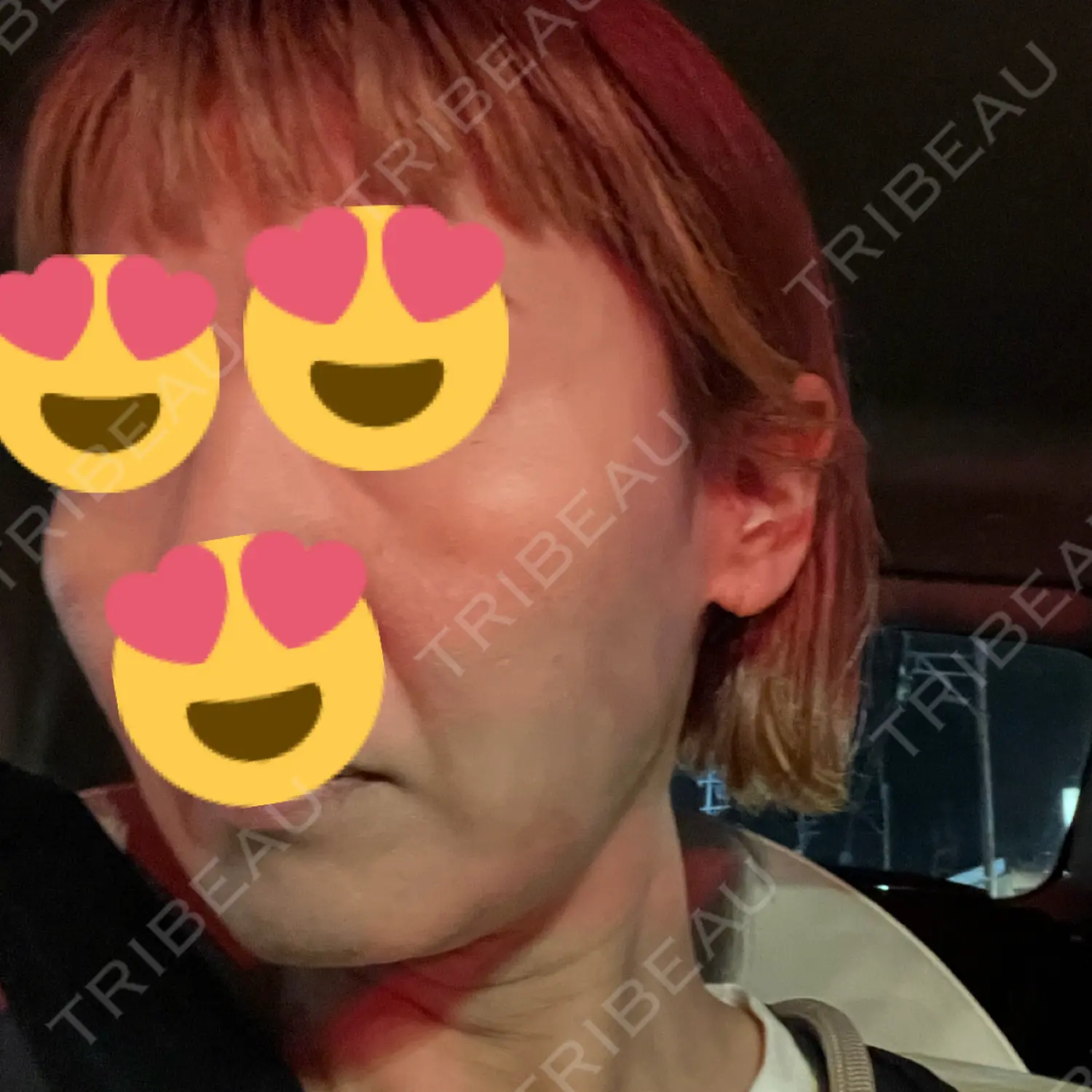 施術前の写真
