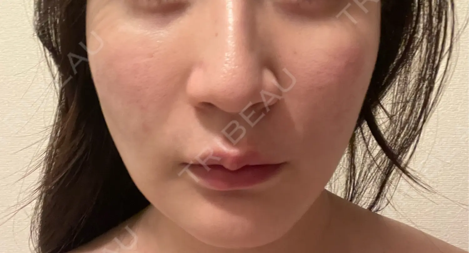 施術前の写真