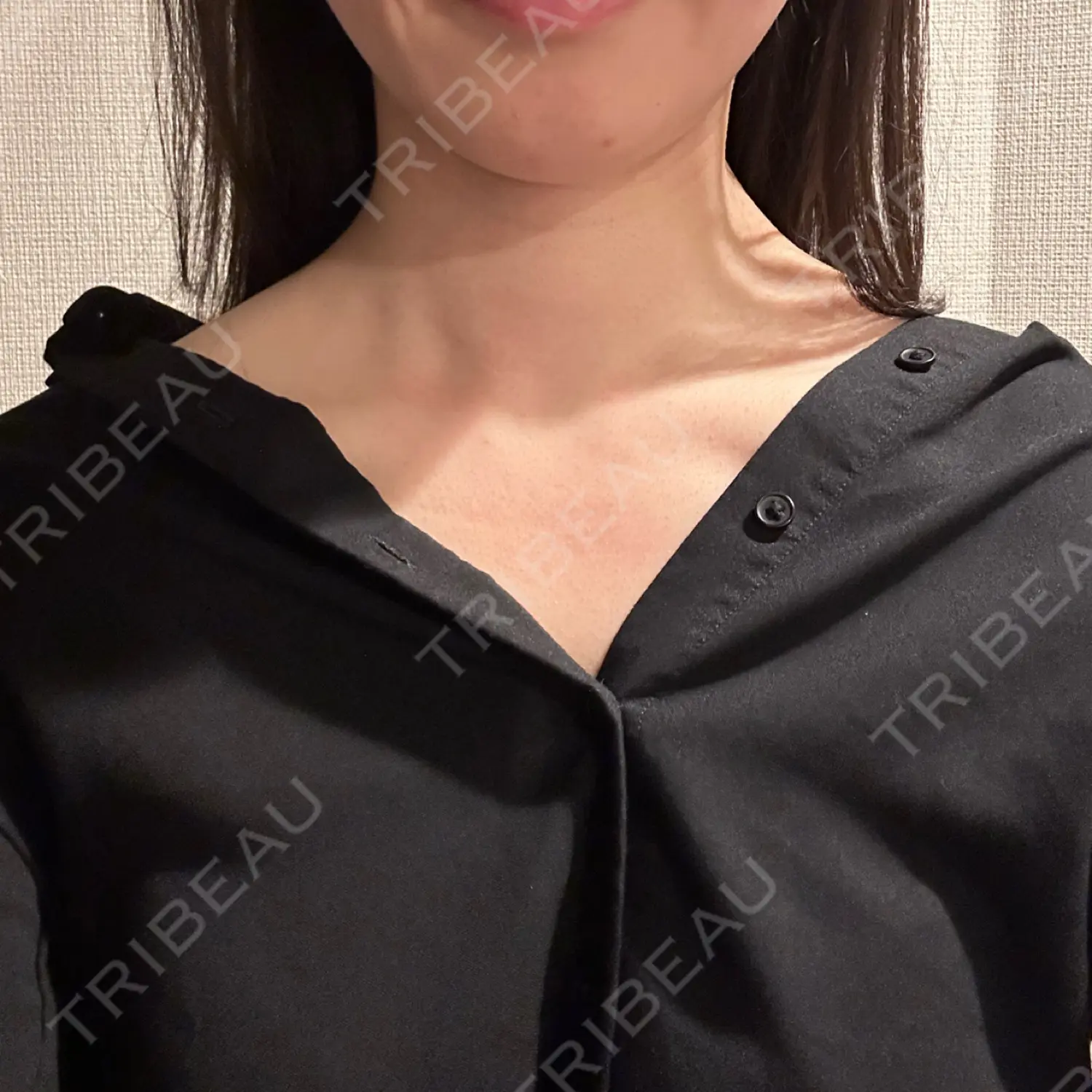 施術前の写真