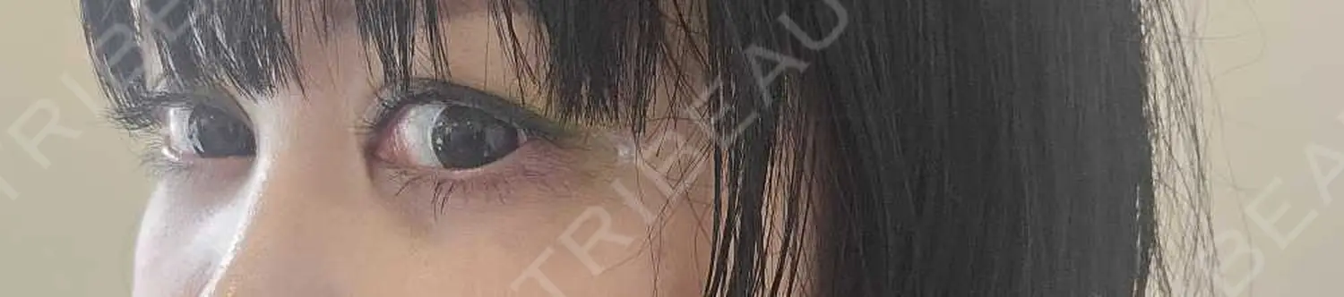施術前の写真