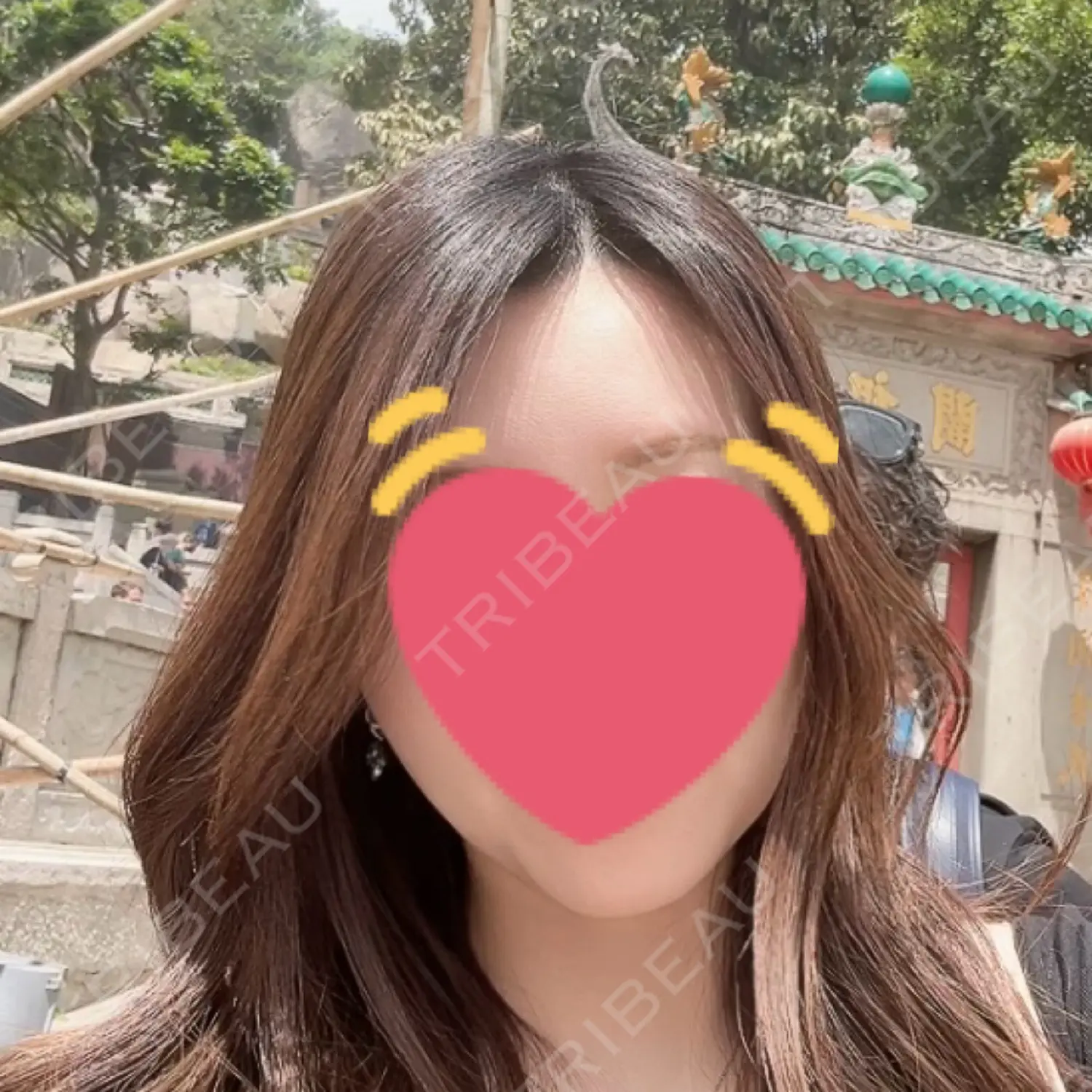 施術前の写真