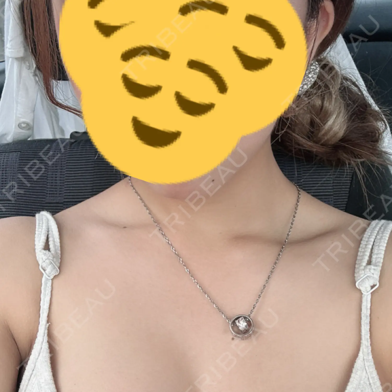 施術前の写真