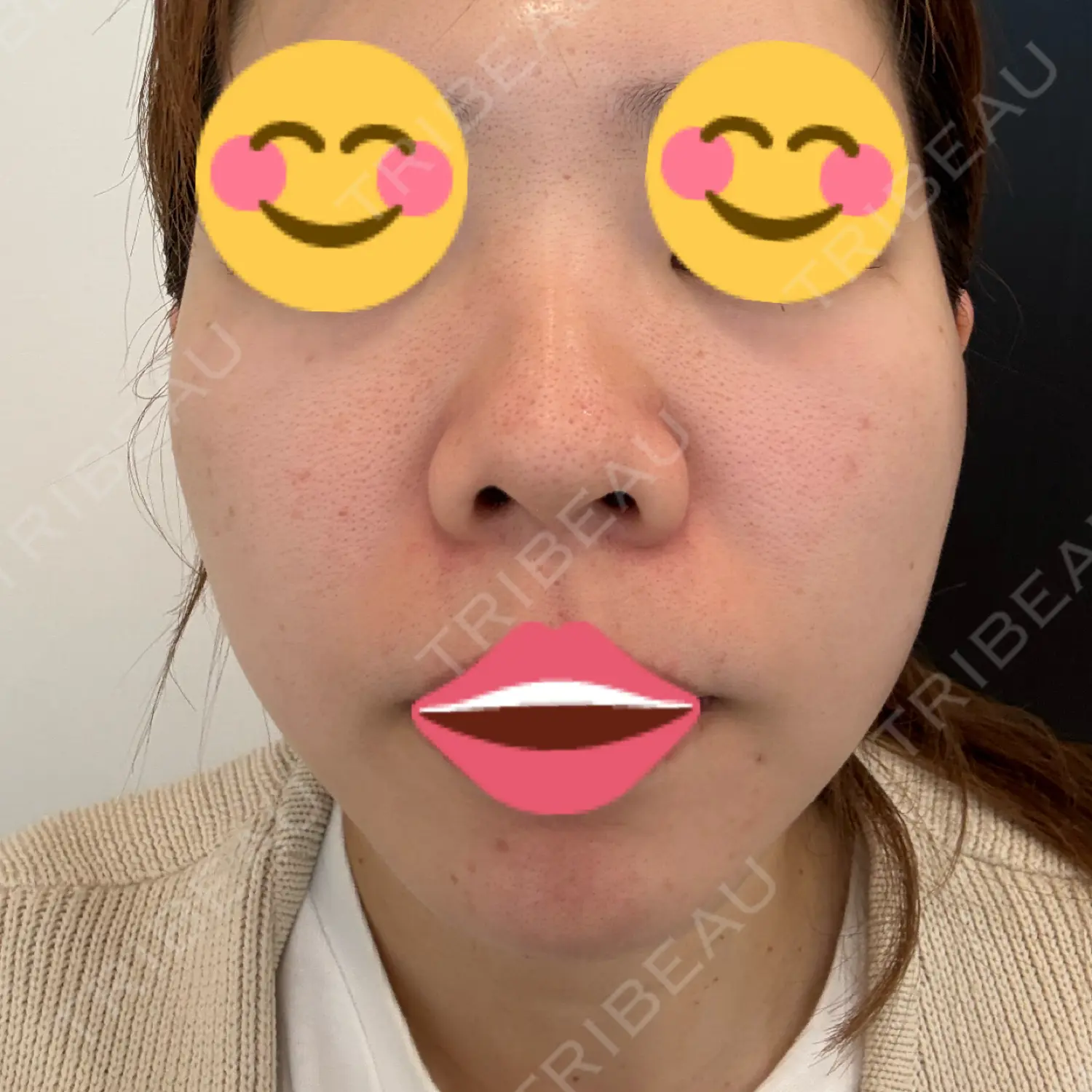 施術前の写真