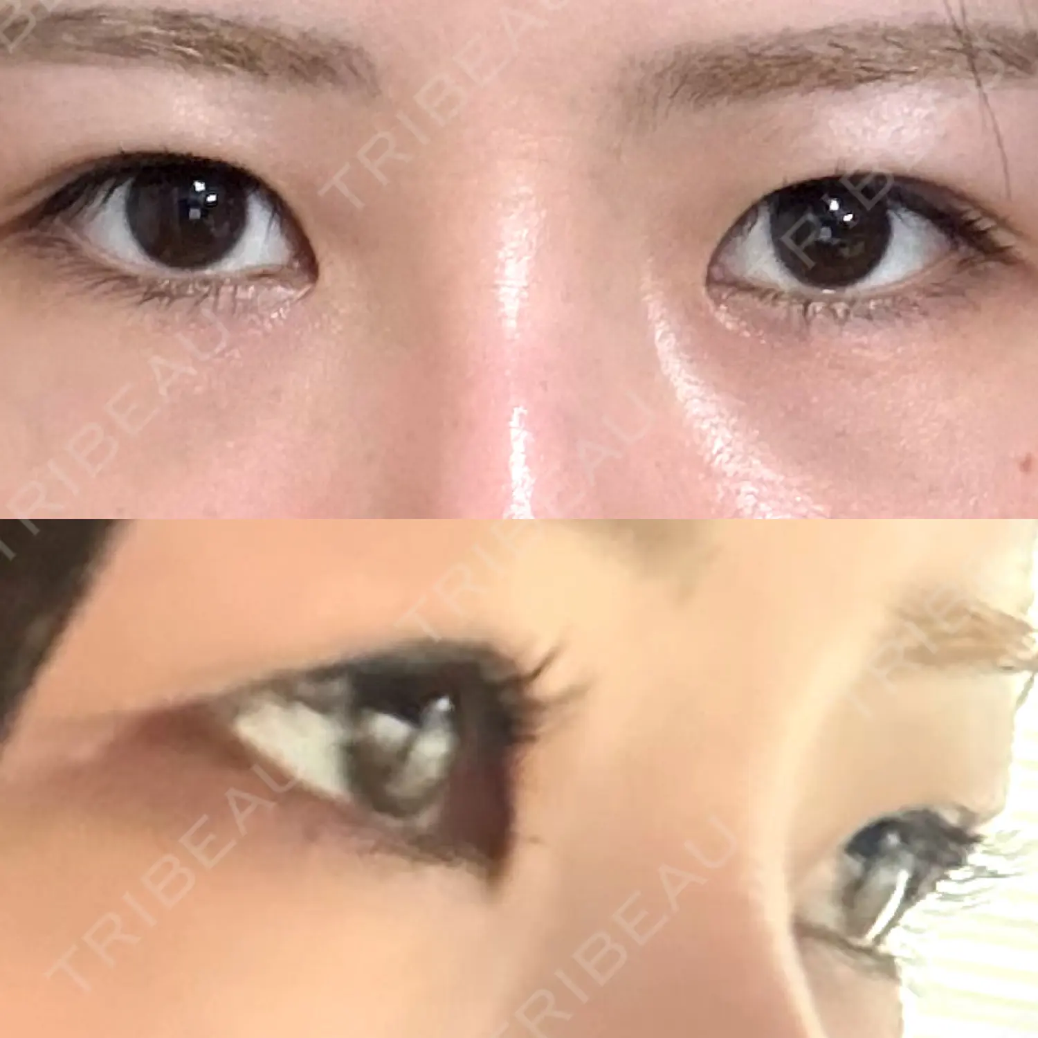 施術前の写真