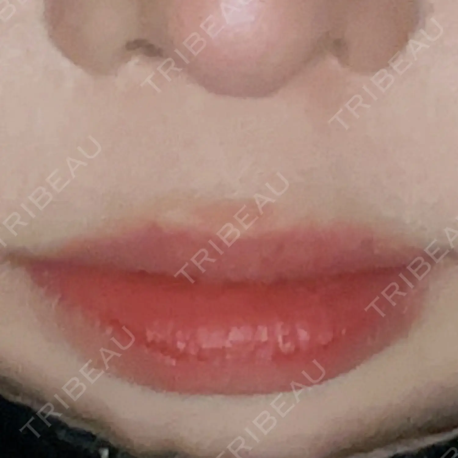 施術前の写真