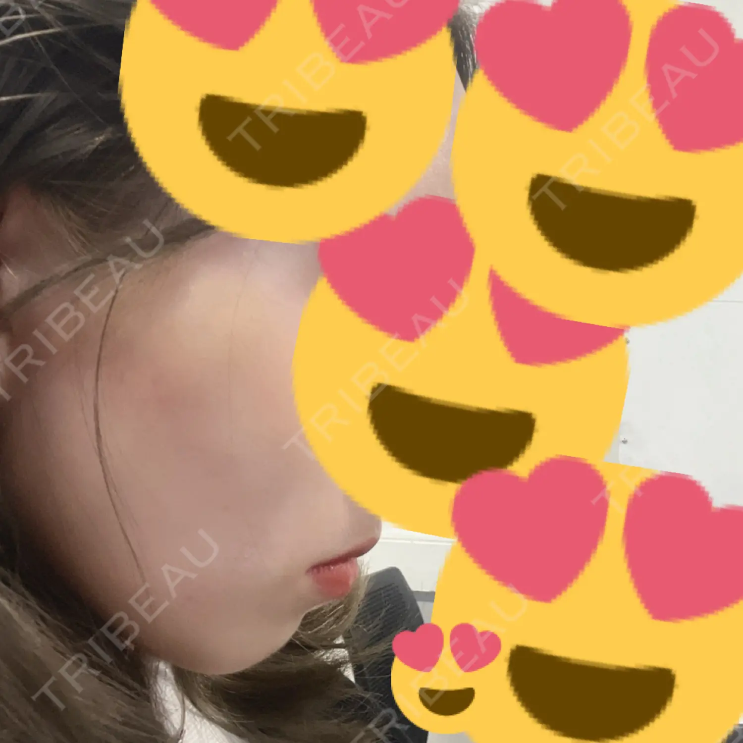施術前の写真
