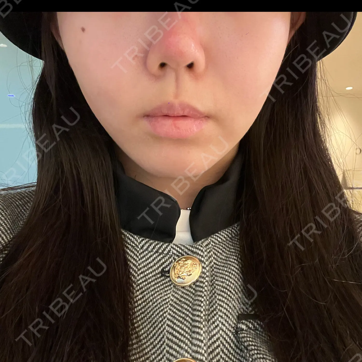 施術前の写真