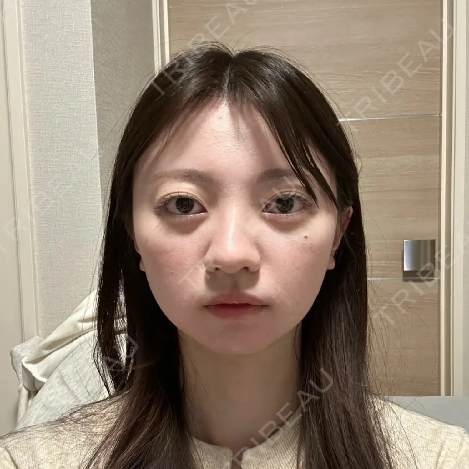 施術前の写真