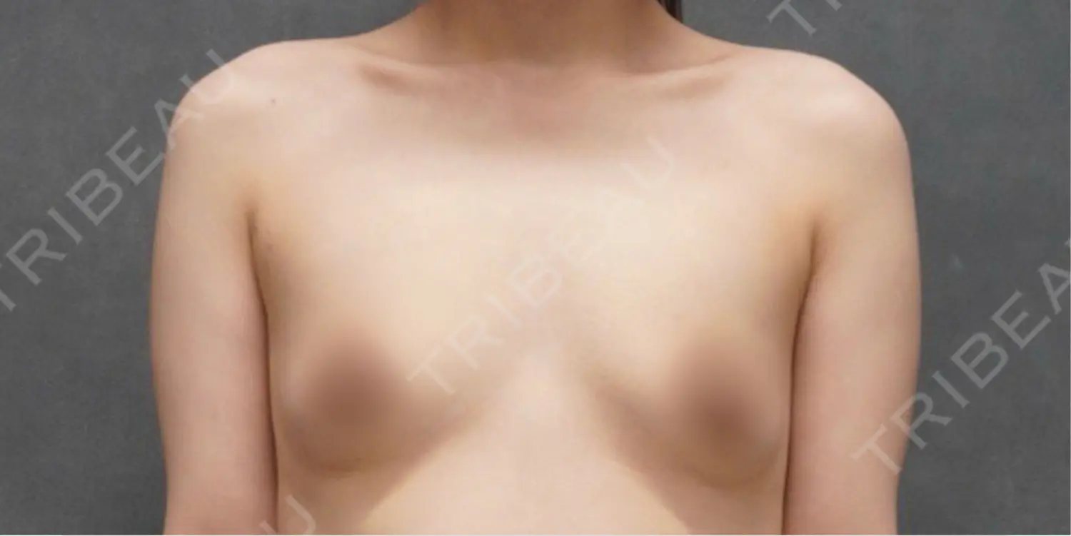 施術前の写真