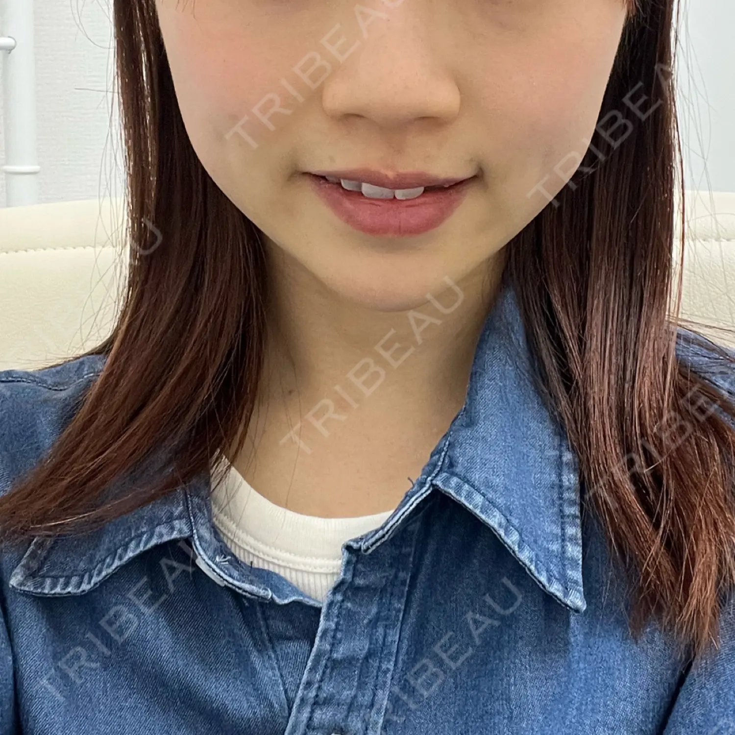 施術前の写真