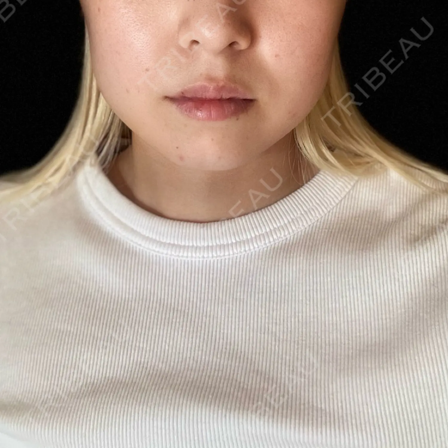 施術前の写真
