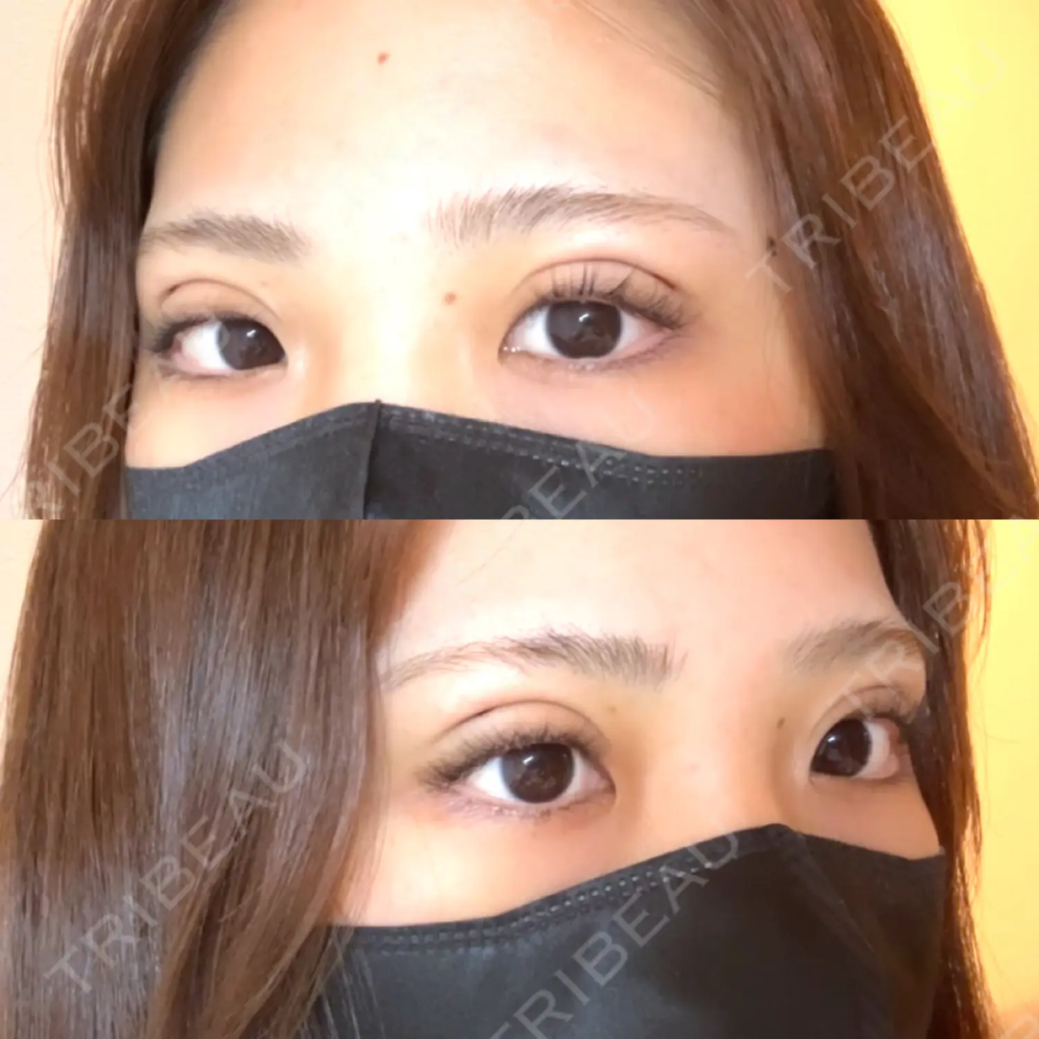 施術前の写真