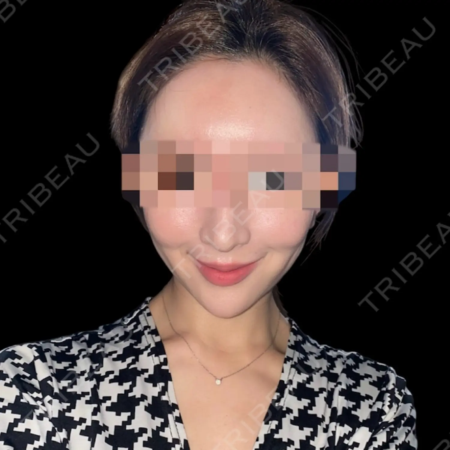 施術前の写真