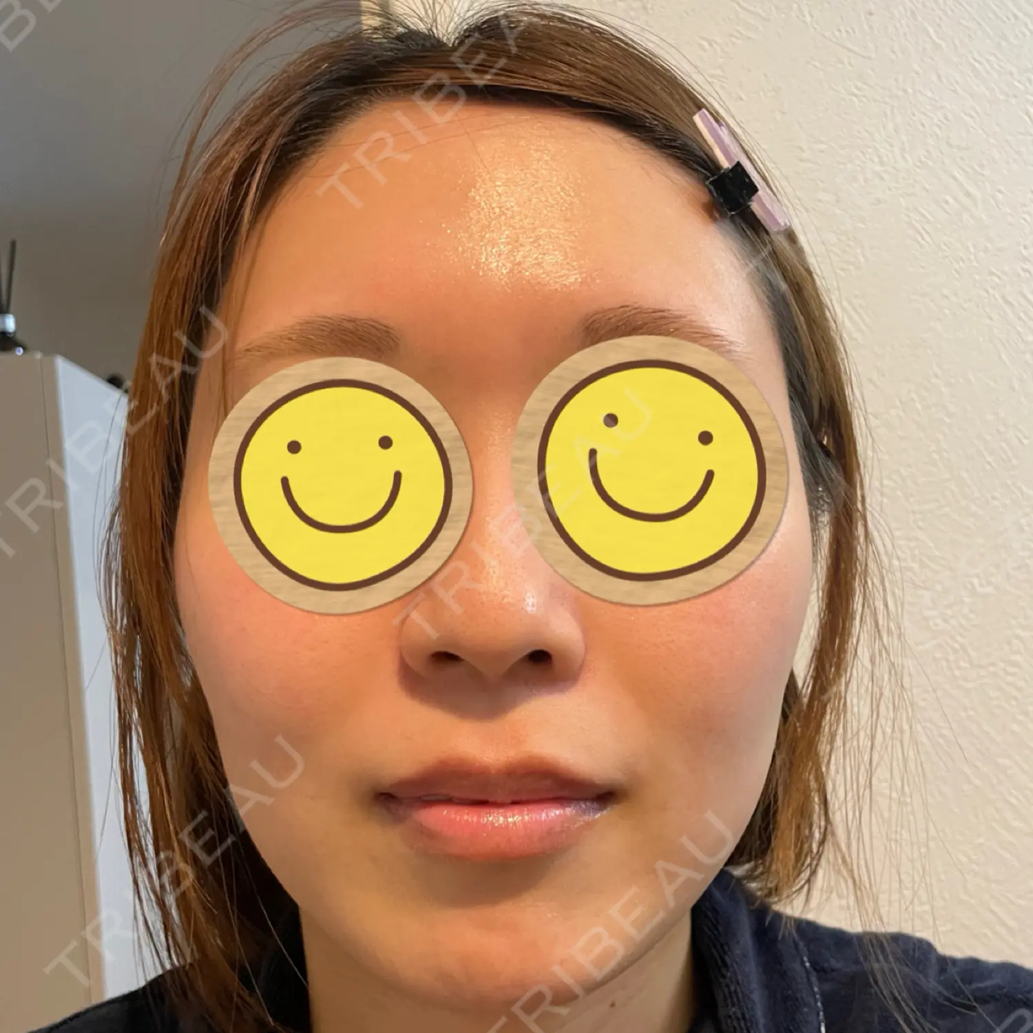 施術前の写真